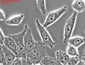 HeLa cell culture